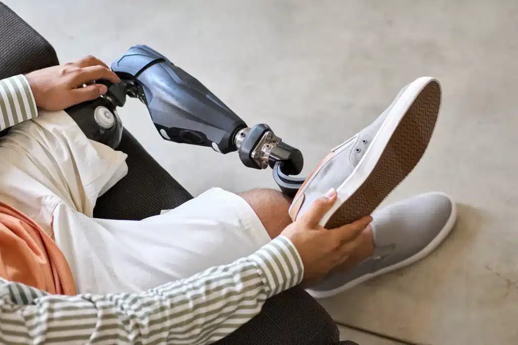 Man with prosthetic leg