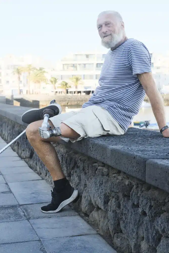 Senior with prosthetic leg
