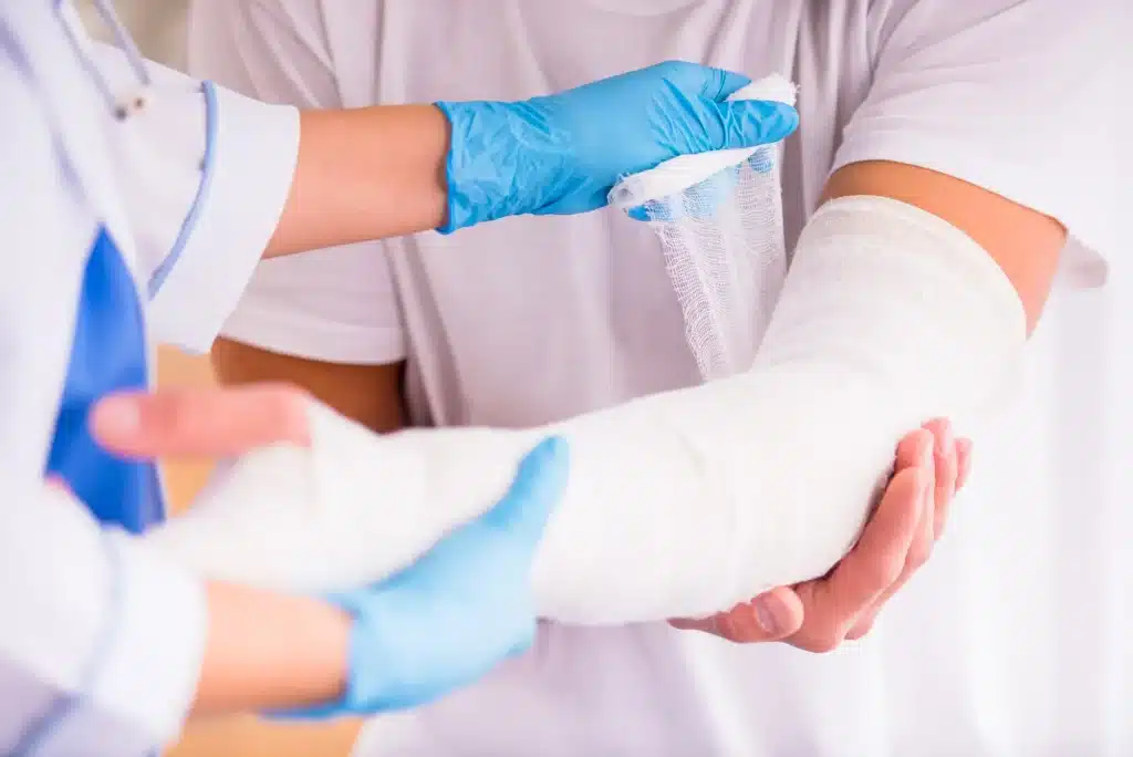 injured arm with cast