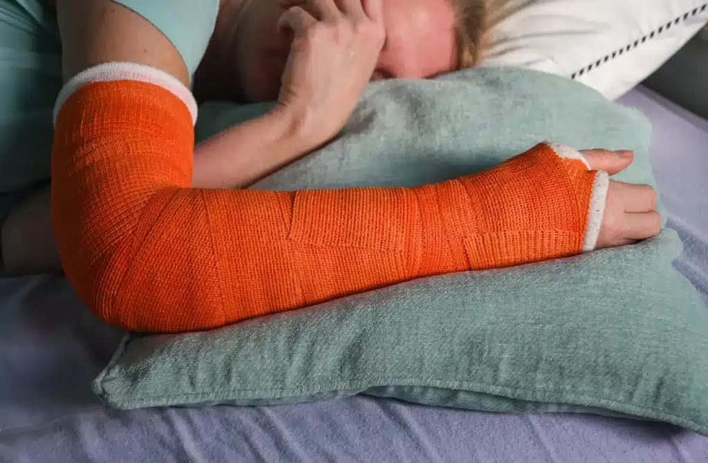 woman with broken right arm